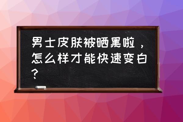 男士脸部美白最快方法 男士皮肤被晒黑啦，怎么样才能快速变白？